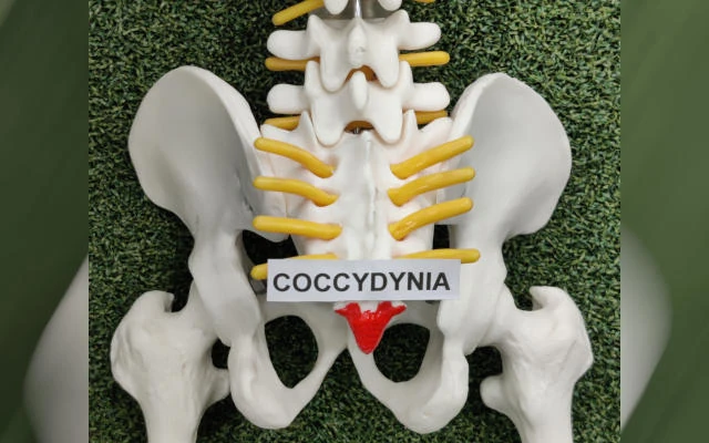 Pelvic and coccyx spine model showing Coccydynia treatment area for tailbone pain, physiotherapy education, and posture correction in Chennai